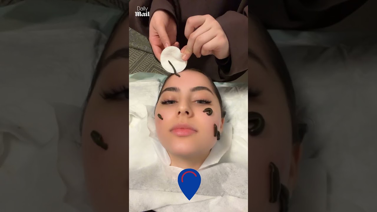 Woman gets leech facial