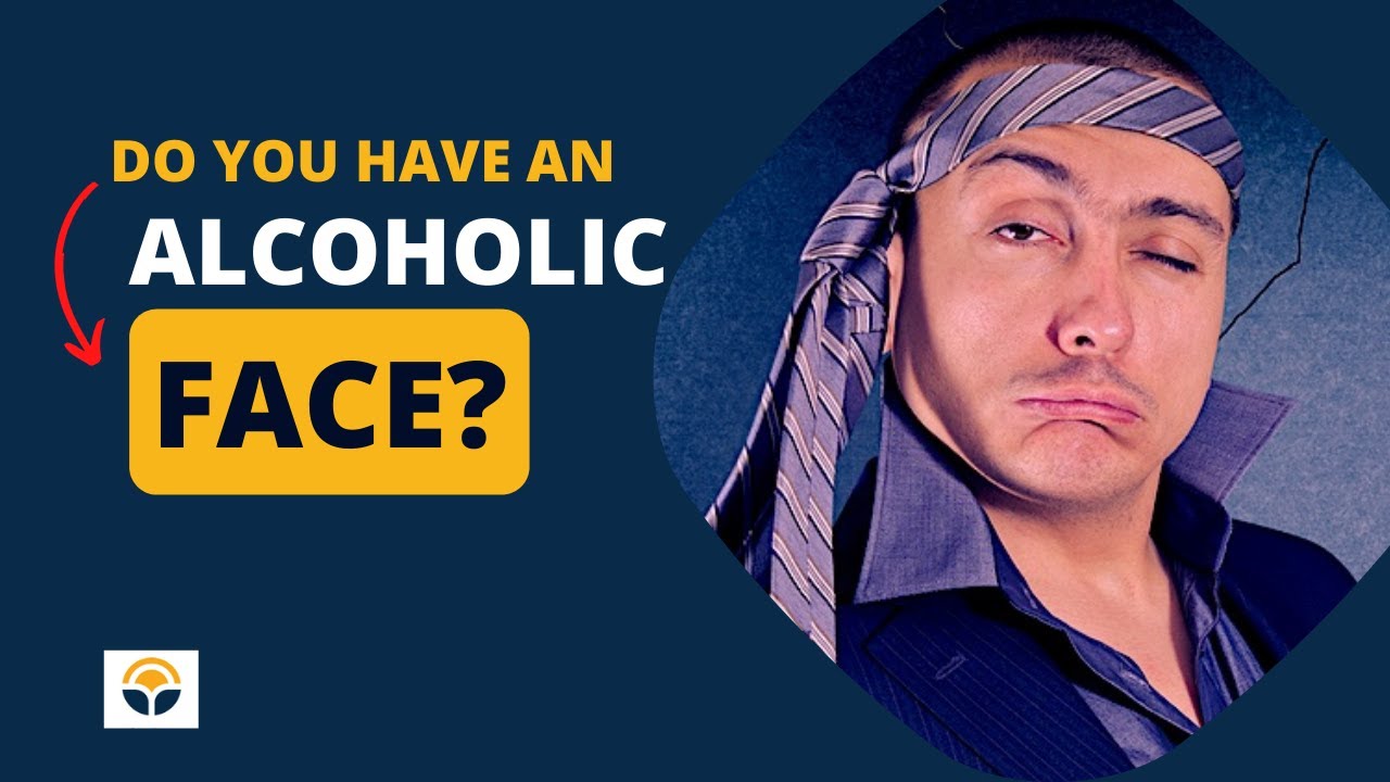 Do You Have an Alcoholic Face?