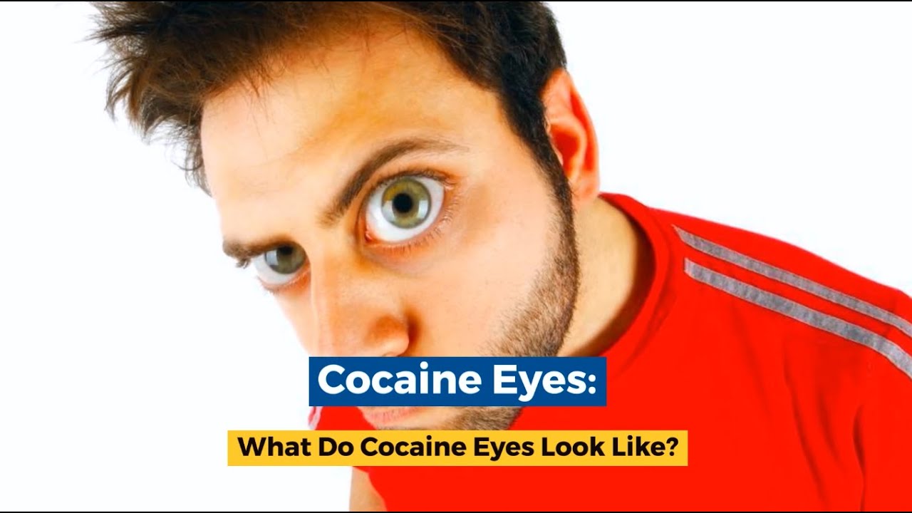 Cocaine Eyes: What Do Cocaine Eyes Look Like?