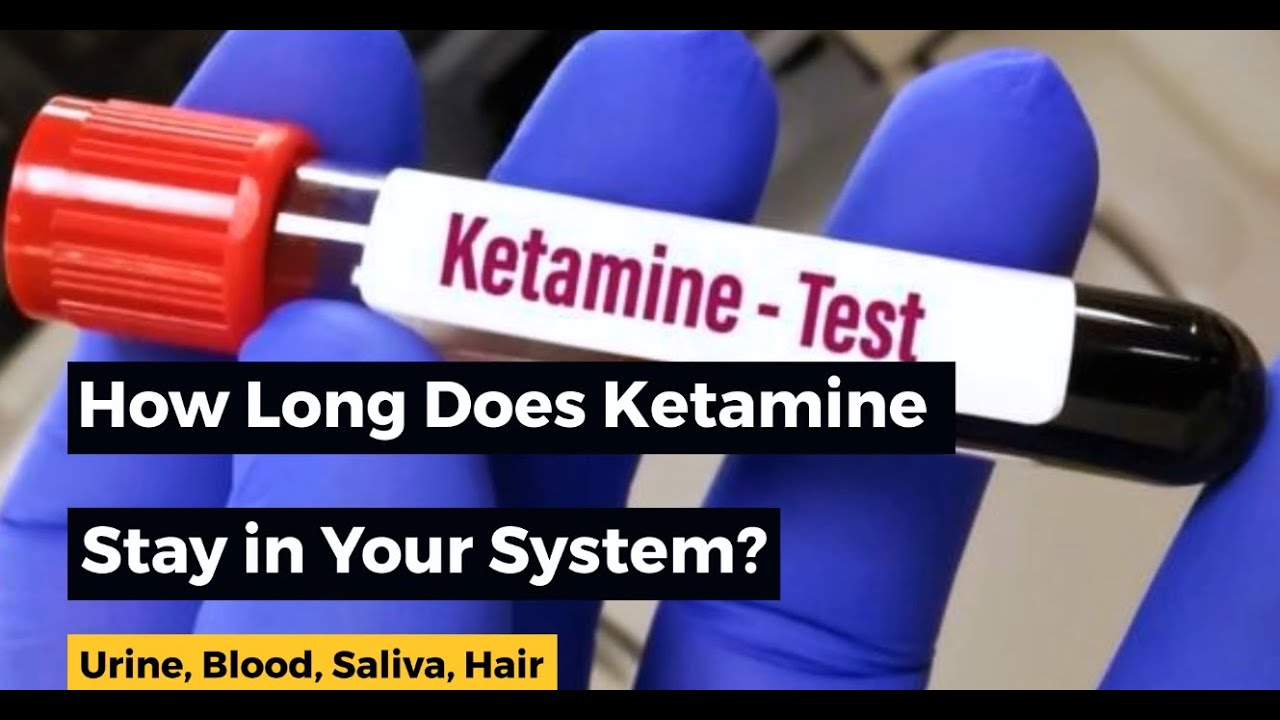 How Long Does Ketamine Stay In Your System?