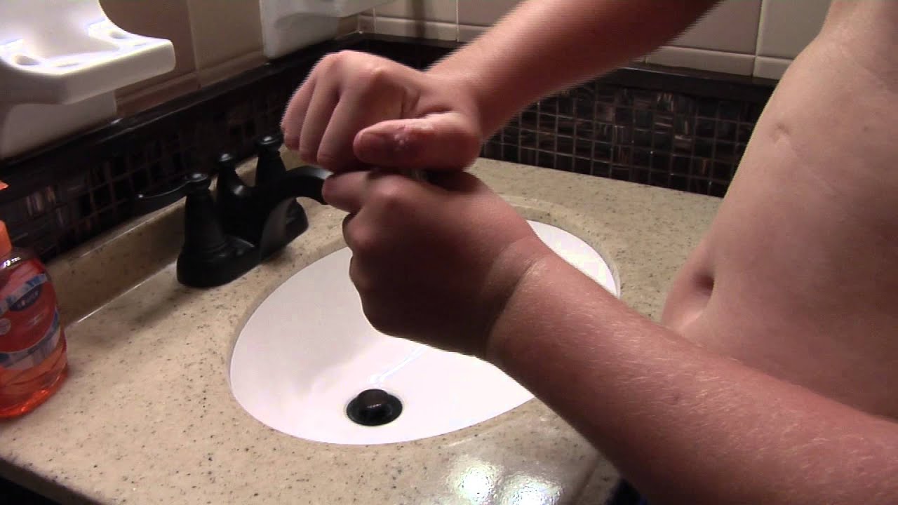 Alarming trends in stimulant use in kids