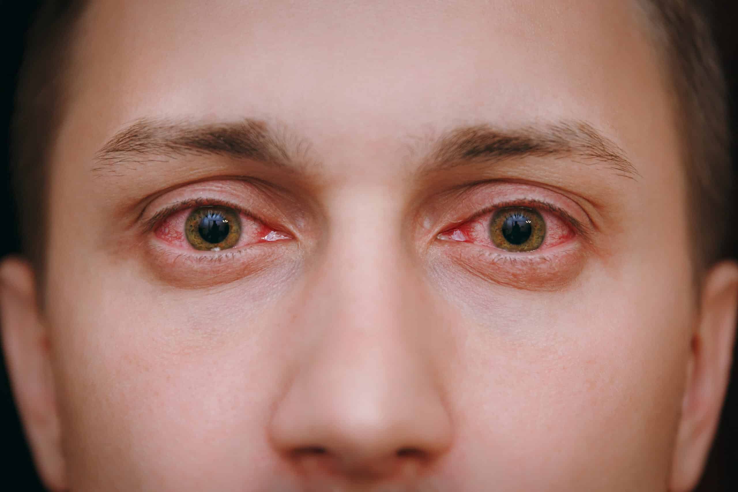 how to tell if someone is high